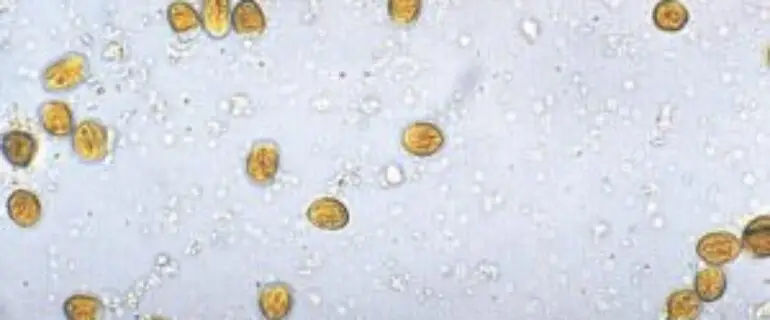 Giardia-sp-cysten-feces-300x184-1-770x320